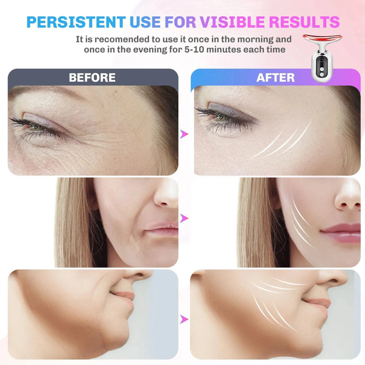 Florance Beauty™ 3-in-1 GlowLift™ Neck &amp; Face Sculptor
