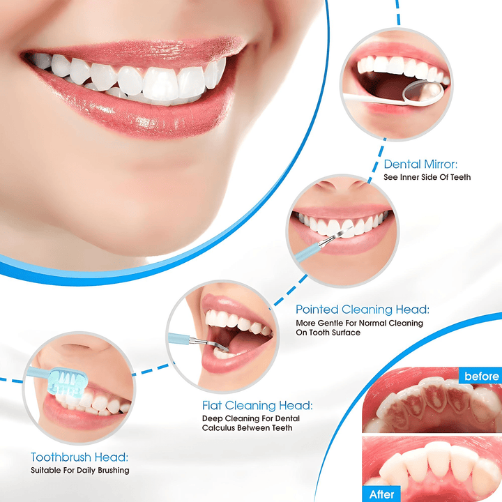 Florance Beauty™ Electric Dental Calculus Remover
